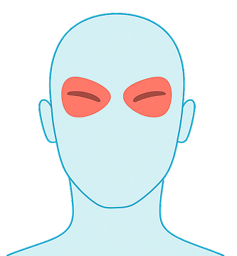 Headache Relief