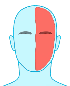 Migraine Attacks